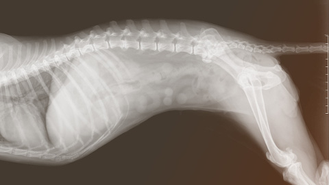 Was ist die Funktion der Wirbelsäule?